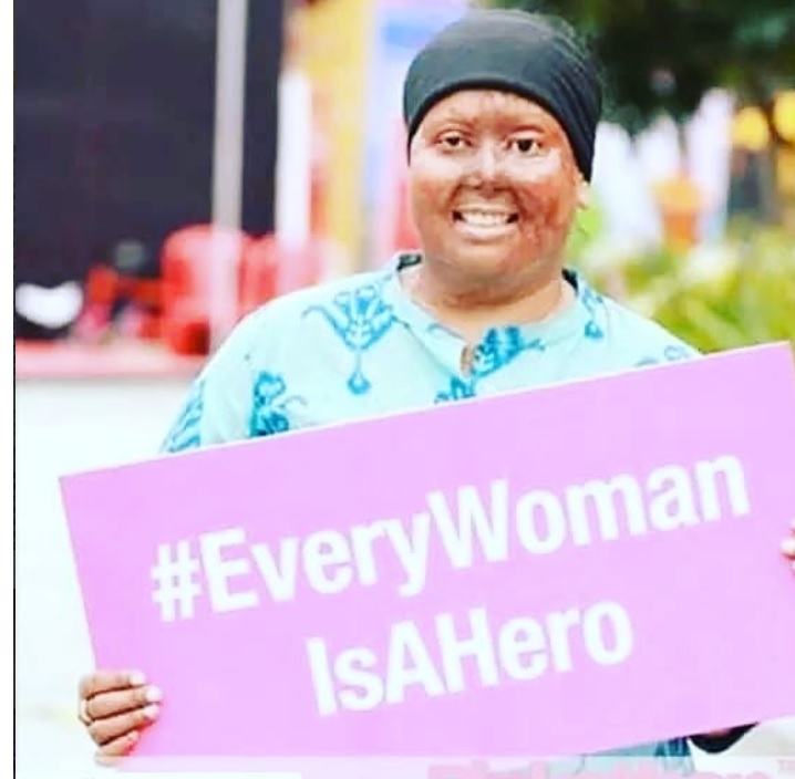 Pragya Prasun Singh acid attack survivor