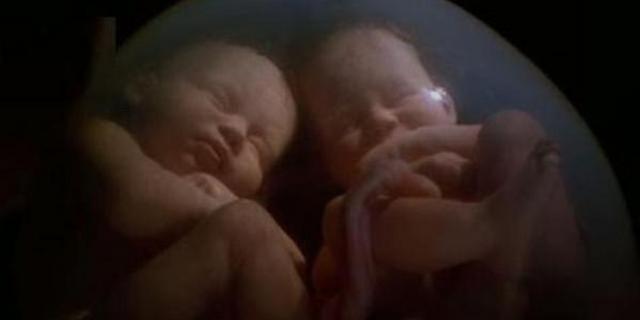 Twins in a mother’s womb